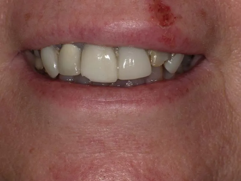 Before photo case 3